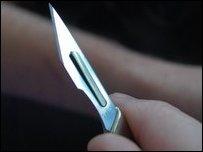 用小刀割擦是自殘的主要形式
